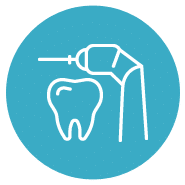 Tratamientos de endodoncia en Mallorca | Dentistas especializados en endodoncias en Palma