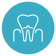 Tratamientos de periodoncia en Palma | Clínica Mallorca Dental