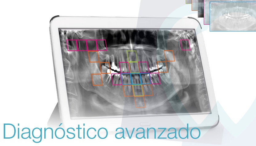 Nueva máquina de diagnóstico dental avanzado | Clínica Mallorca Dental