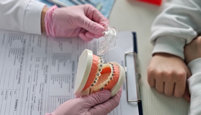 Diferencias entre ortodoncia preventiva, interceptiva y correctiva